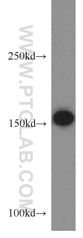 Western Blot (WB) analysis of HEK-293 cells using MSH6 Polyclonal antibody (18120-1-AP)