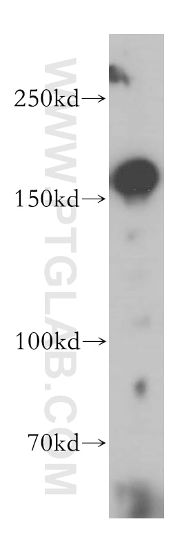 Western Blot (WB) analysis of HEK-293 cells using MSH6 Polyclonal antibody (18120-1-AP)