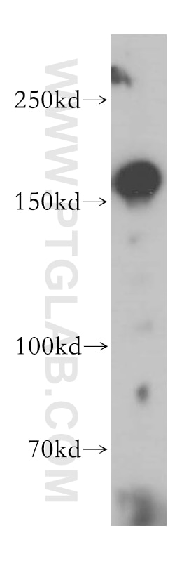 WB analysis of HEK-293 using 18120-1-AP