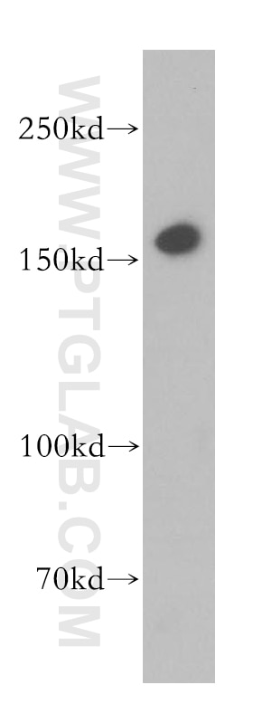 Western Blot (WB) analysis of HeLa cells using MSH6 Polyclonal antibody (18120-1-AP)