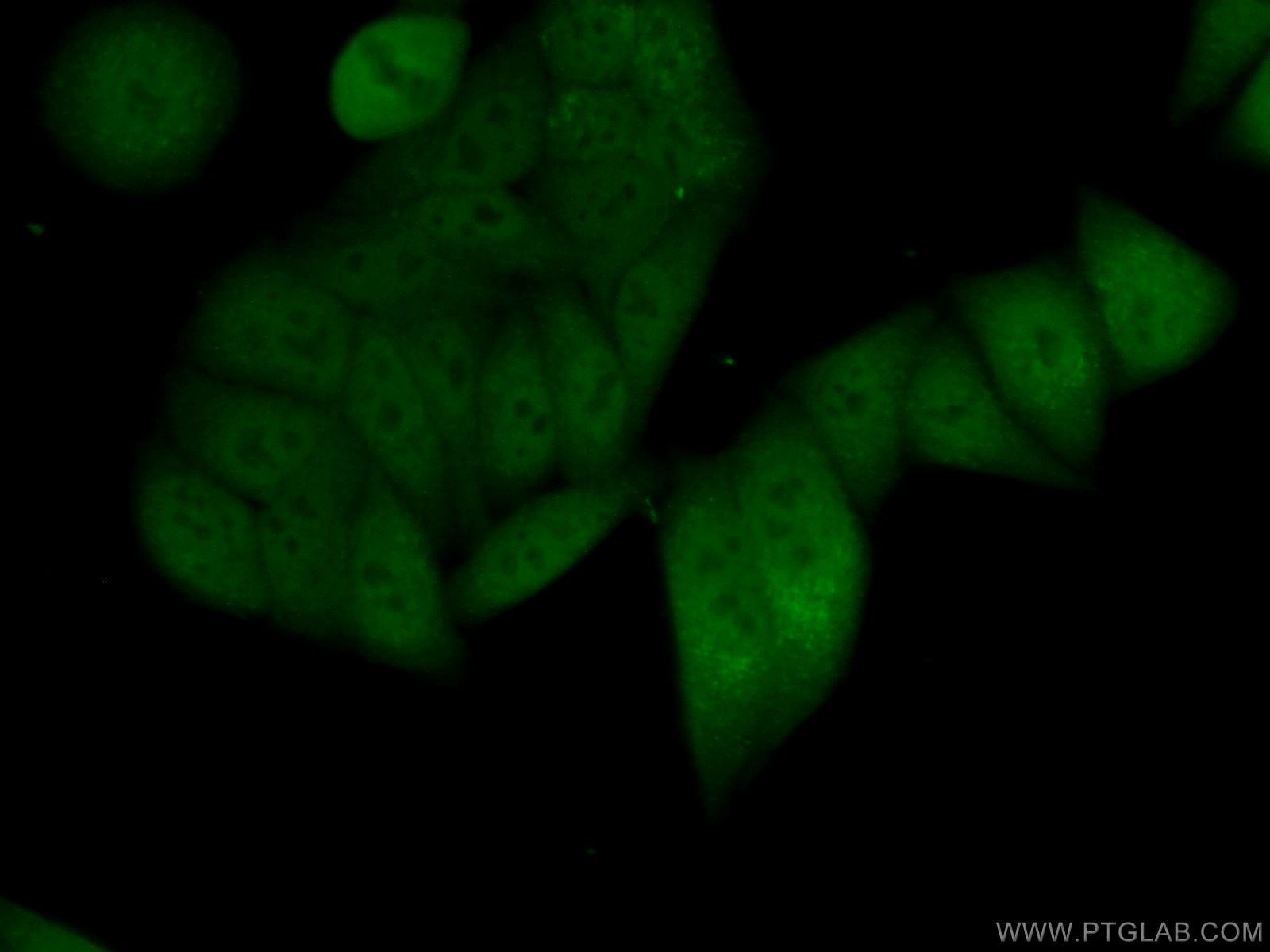 Immunofluorescence (IF) / fluorescent staining of HepG2 cells using MSH6 Monoclonal antibody (66172-1-Ig)