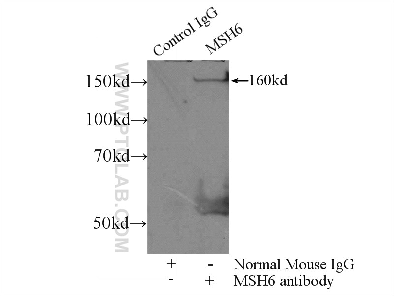 Immunoprecipitation (IP) experiment of HEK-293 cells using MSH6 Monoclonal antibody (66172-1-Ig)