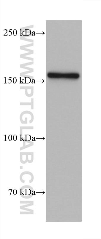 Western Blot (WB) analysis of U2OS cells using MSH6 Monoclonal antibody (66172-1-Ig)