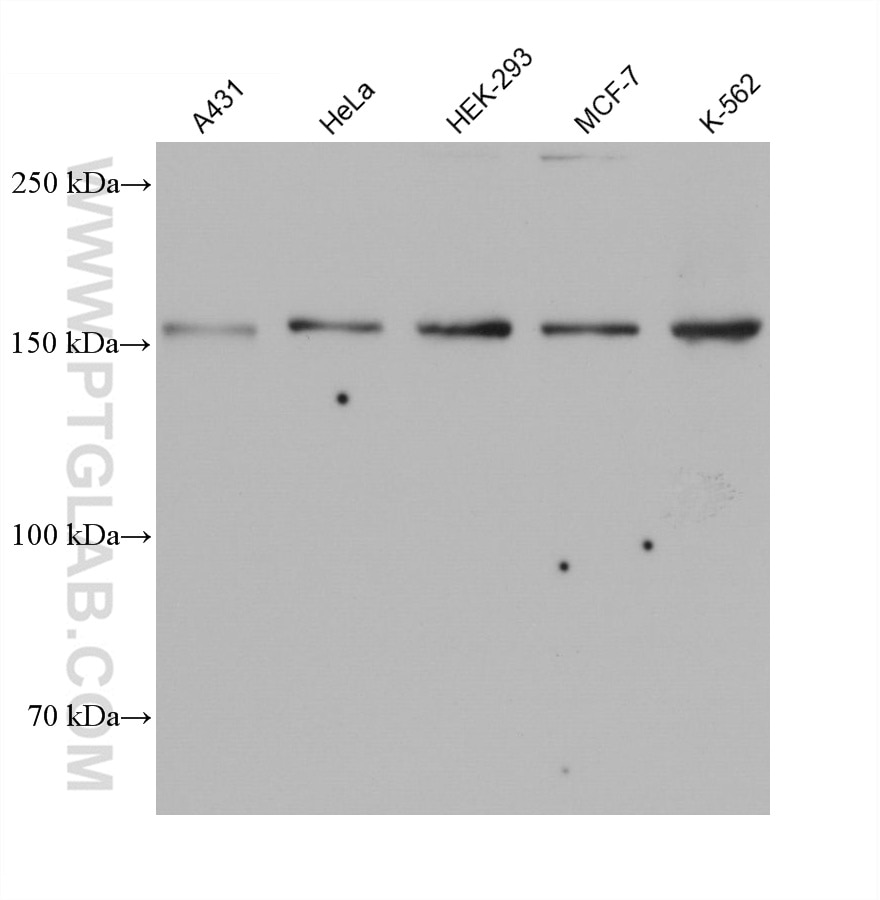 Western Blot (WB) analysis of various lysates using MSH6 Monoclonal antibody (66172-1-Ig)