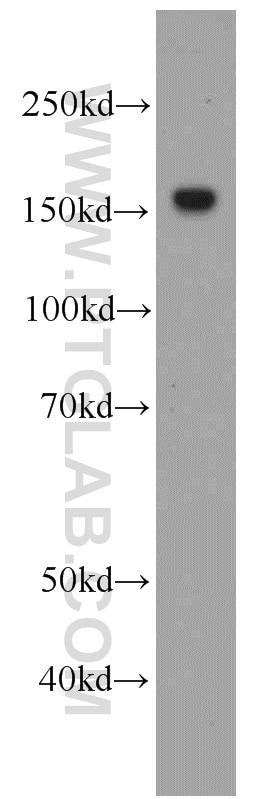 Western Blot (WB) analysis of HepG2 cells using MSH6 Monoclonal antibody (66172-1-Ig)