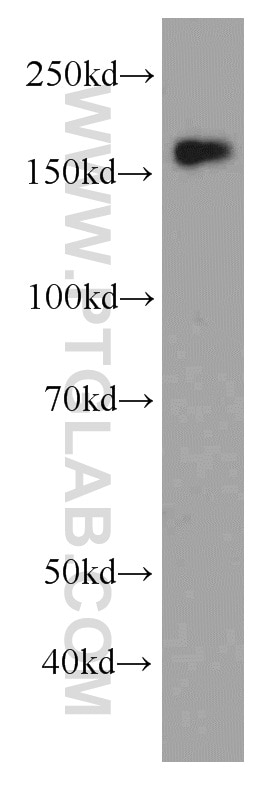 Western Blot (WB) analysis of HEK-293 cells using MSH6 Monoclonal antibody (66172-1-Ig)