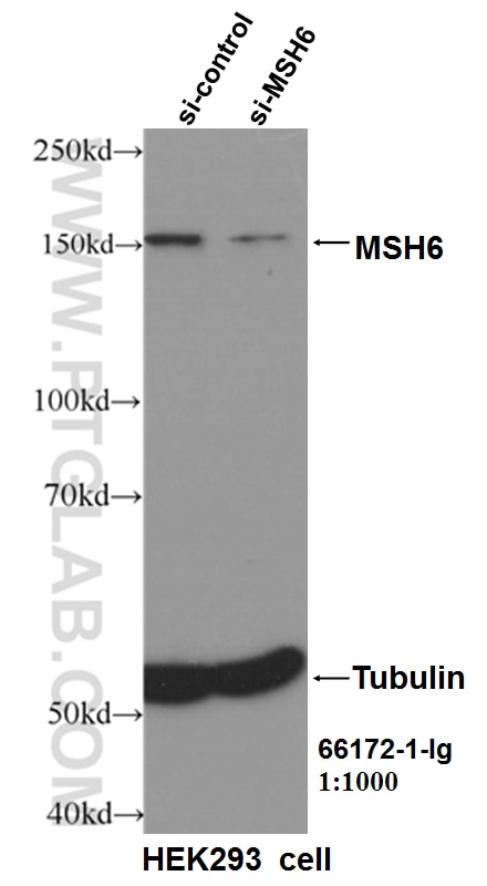 Western Blot (WB) analysis of HEK-293 cells using MSH6 Monoclonal antibody (66172-1-Ig)