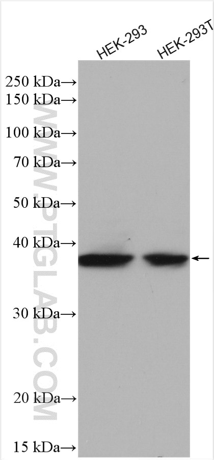 Western Blot (WB) analysis of various lysates using MSI1 Polyclonal antibody (27185-1-AP)