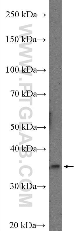 Western Blot (WB) analysis of Caco-2 cells using MSI1 Polyclonal antibody (27185-1-AP)