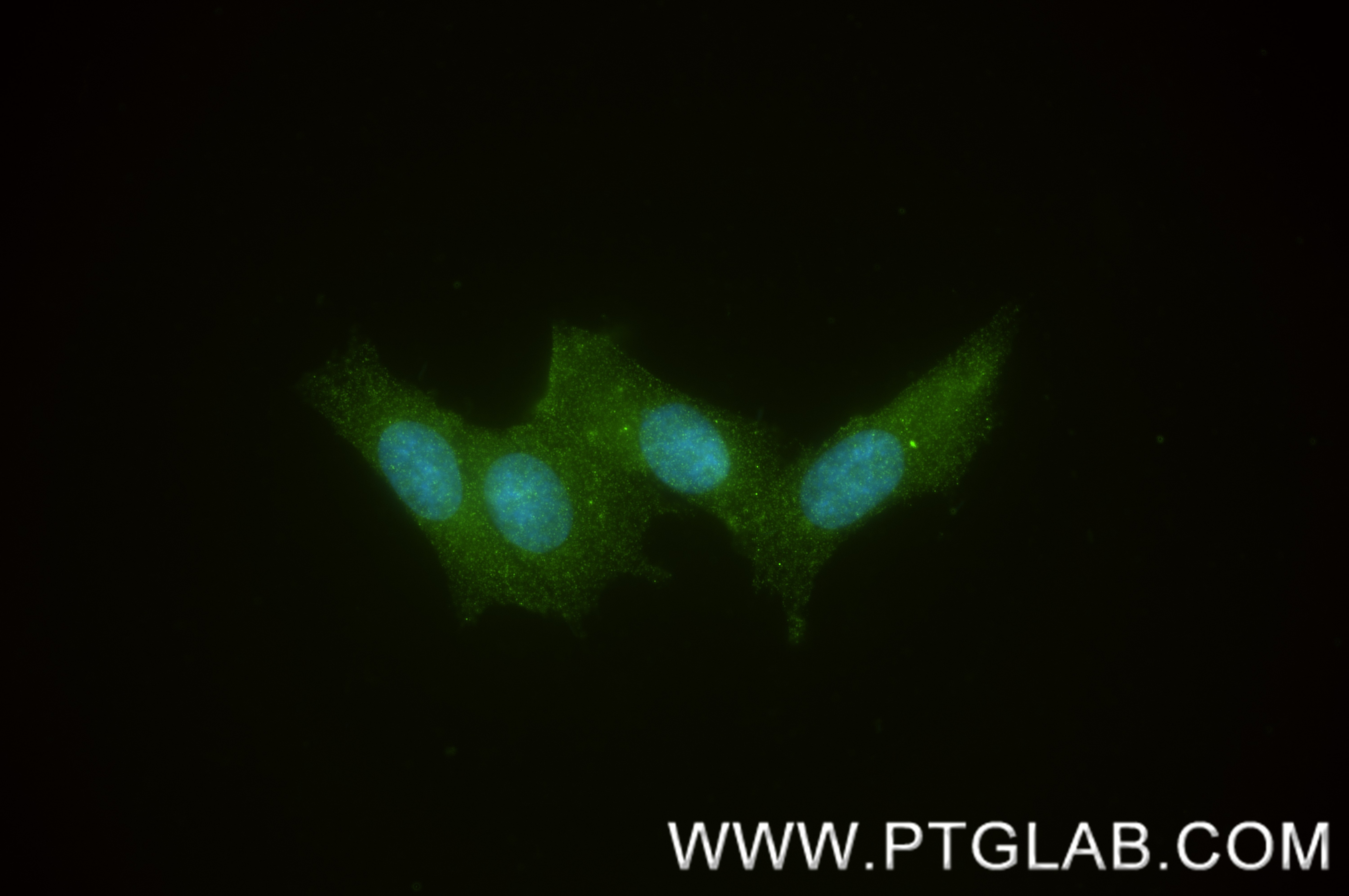 IF Staining of SH-SY5Y using 86723-1-RR (same clone as 86723-1-PBS) Immunofluorescence (IF) / fluorescent staining of SH-SY5Y cells using MSI1 Recombinant monoclonal antibody (86723-1-RR)