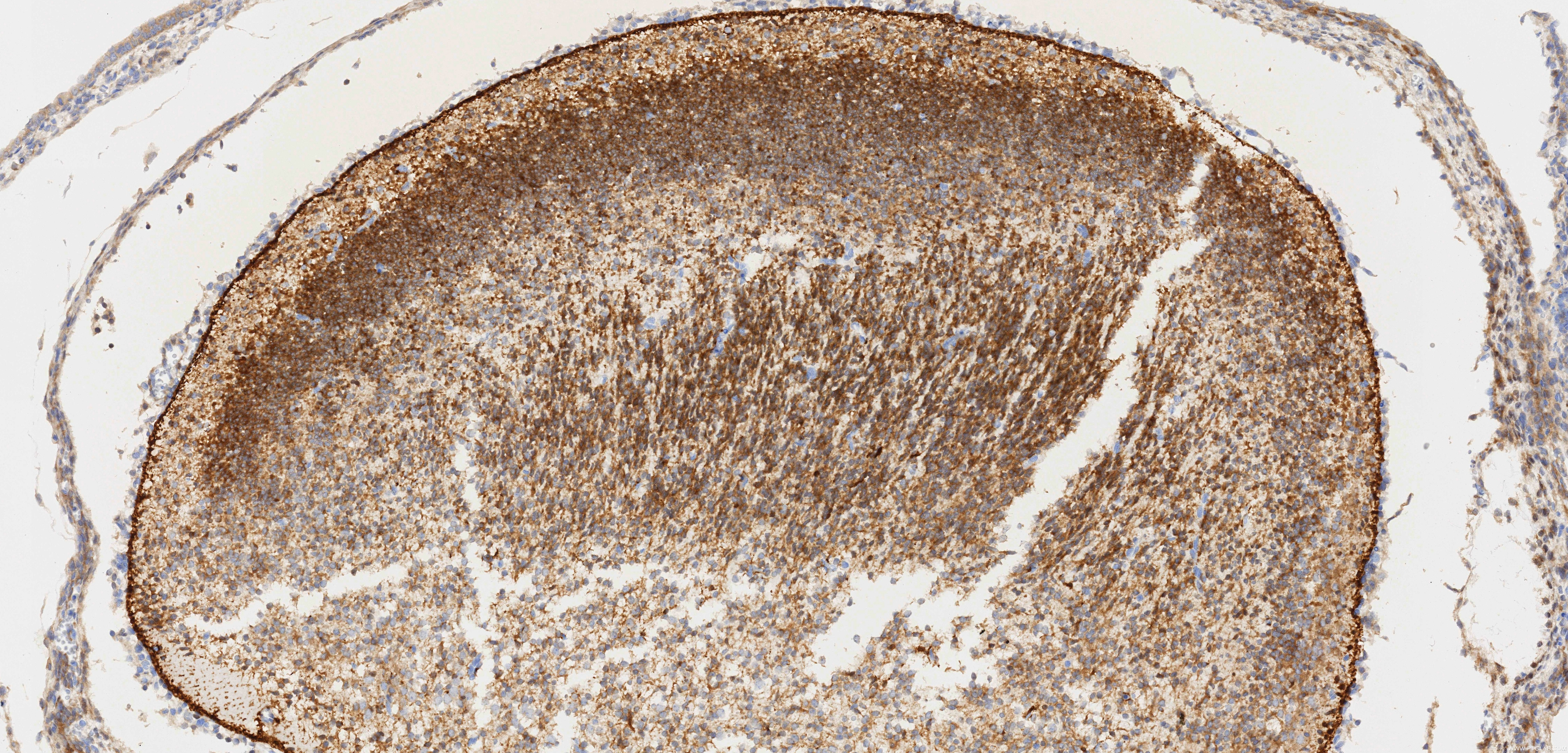 Immunohistochemistry (IHC) staining of mouse embryo tissue using MSI1 Recombinant monoclonal antibody (86723-1-RR)