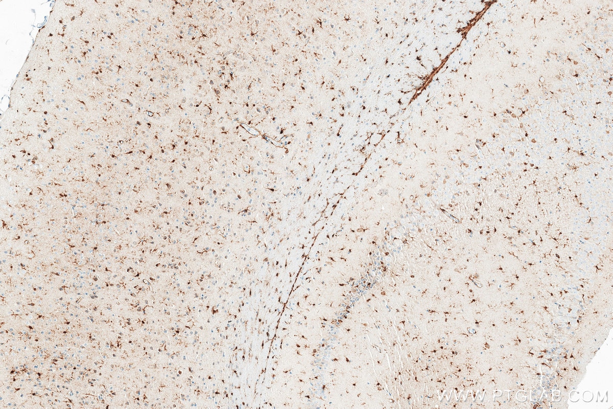 IHC staining of mouse brain using 86723-1-RR (same clone as 86723-1-PBS) Immunohistochemistry (IHC) staining of mouse brain tissue using MSI1 Recombinant monoclonal antibody (86723-1-RR)