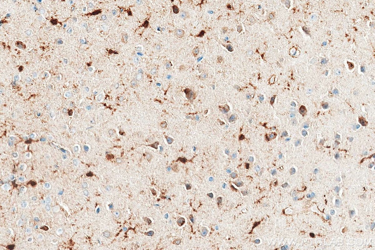 IHC staining of mouse brain using 86723-1-RR (same clone as 86723-1-PBS) Immunohistochemistry (IHC) staining of mouse brain tissue using MSI1 Recombinant monoclonal antibody (86723-1-RR)