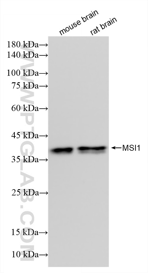 Western Blot (WB) analysis of various lysates using MSI1 Recombinant monoclonal antibody (86723-1-RR)