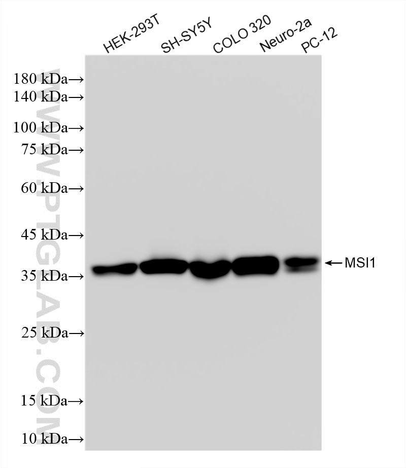 Western Blot (WB) analysis of various lysates using MSI1 Recombinant monoclonal antibody (86723-1-RR)
