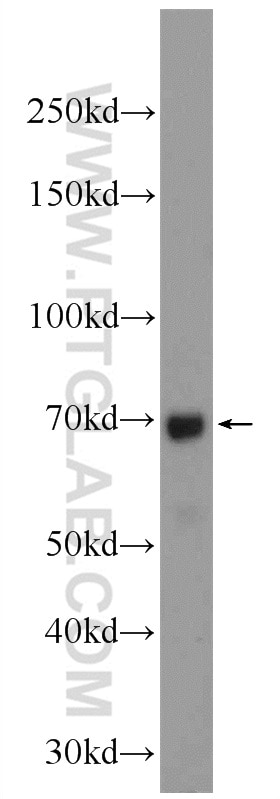 Western Blot (WB) analysis of HeLa cells using MSL1 Polyclonal antibody (24373-1-AP)