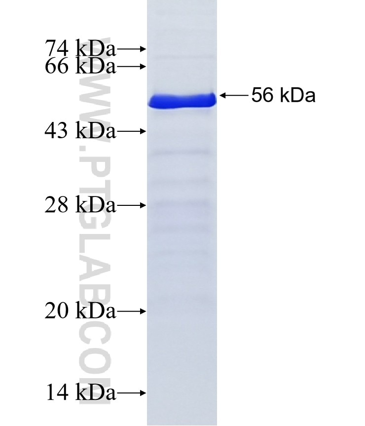 MSL1 fusion protein Ag19174 SDS-PAGE MSL1 fusion protein Ag19174 SDS-PAGE