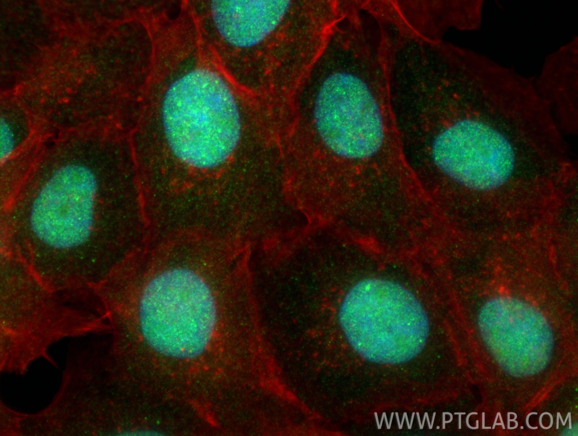 IF Staining of A431 using 23601-1-AP Immunofluorescence (IF) / fluorescent staining of A431 cells using MSL2 Polyclonal antibody (23601-1-AP)