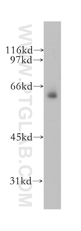 Western Blot (WB) analysis of mouse skeletal muscle tissue using MSL3 Polyclonal antibody (12977-1-AP)