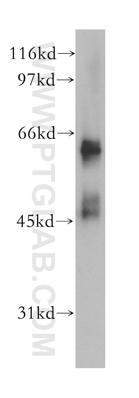 Western Blot (WB) analysis of human stomach tissue using MSL3 Polyclonal antibody (12977-1-AP)