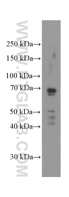 Western Blot (WB) analysis of HeLa cells using Mesothelin Monoclonal antibody (66404-1-Ig)