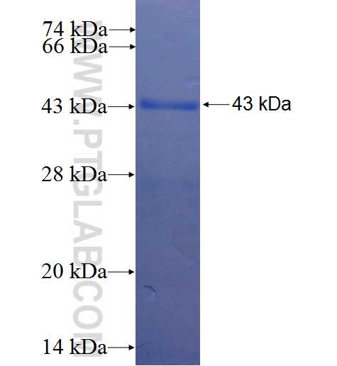 MSLN fusion protein Ag23606 SDS-PAGE