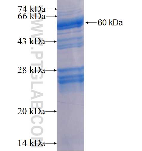 MSLN fusion protein Ag7981 SDS-PAGE