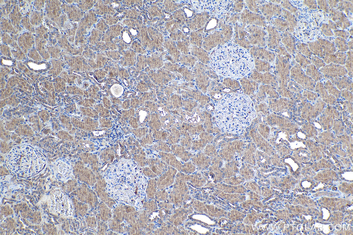 Immunohistochemistry (IHC) staining of human kidney tissue using MSMB Polyclonal antibody (15888-1-AP)
