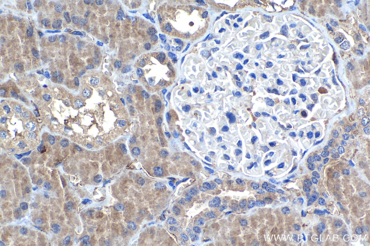 IHC staining of human kidney using 15888-1-AP