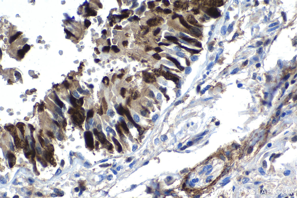 Immunohistochemistry (IHC) staining of human lung tissue using MSMB Polyclonal antibody (15888-1-AP)