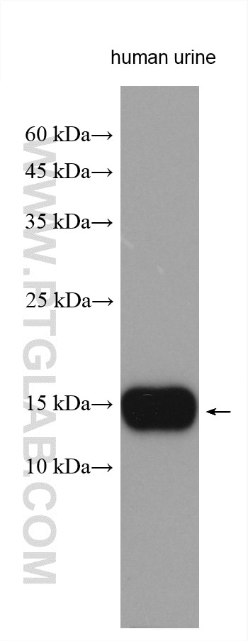 Western Blot (WB) analysis of various lysates using MSMB Polyclonal antibody (15888-1-AP)