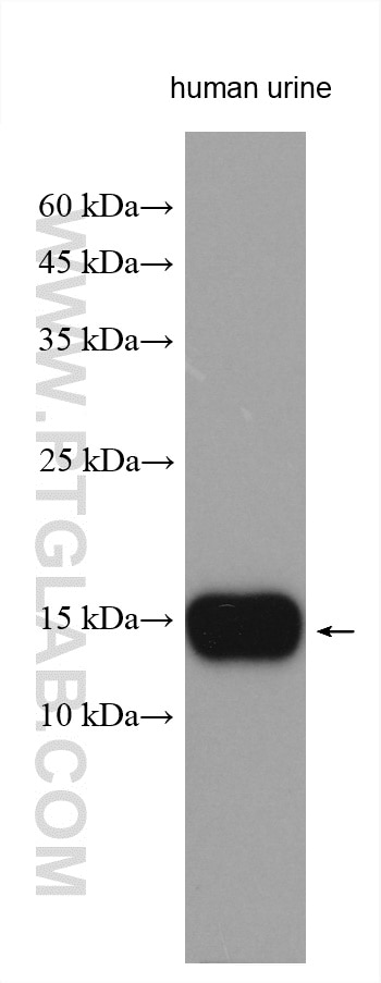 WB analysis using 15888-1-AP