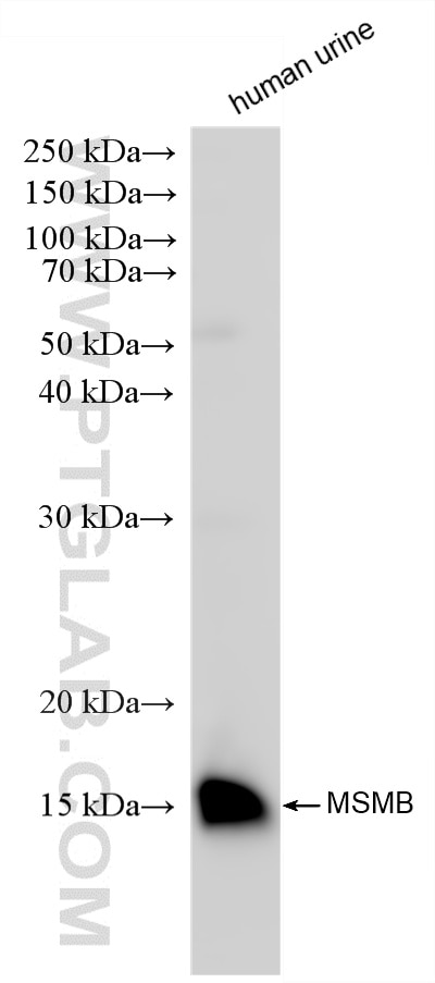 Western Blot (WB) analysis of human urine sample using MSMB Recombinant monoclonal antibody (87375-1-RR)