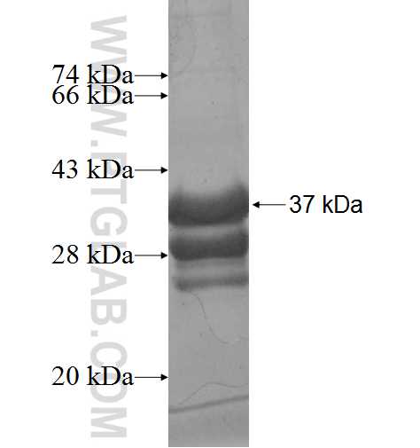 MSMB fusion protein Ag8674 SDS-PAGE