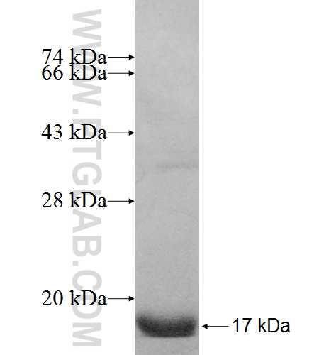 MSMB fusion protein Ag8685 SDS-PAGE