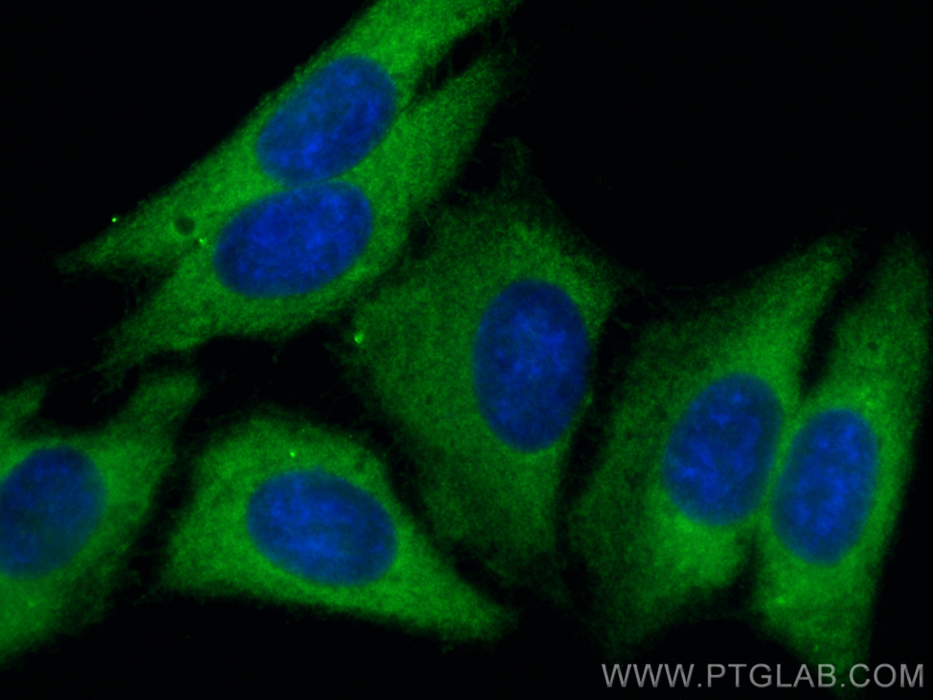 Immunofluorescence (IF) / fluorescent staining of HepG2 cells using Moesin Polyclonal antibody (16495-1-AP)
