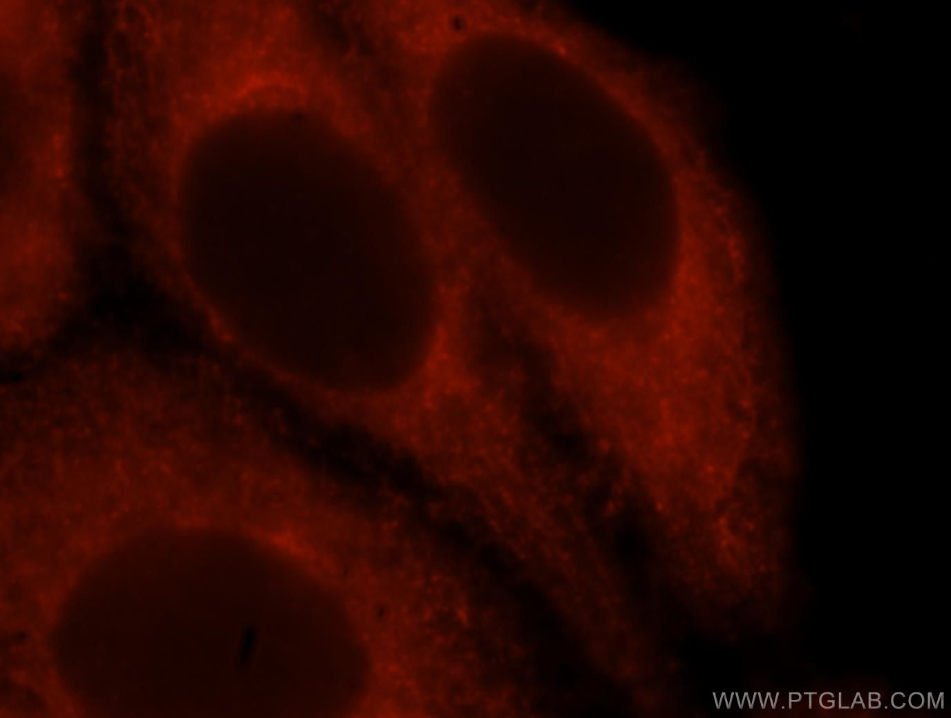 Immunofluorescence (IF) / fluorescent staining of HepG2 cells using Moesin Polyclonal antibody (16495-1-AP)