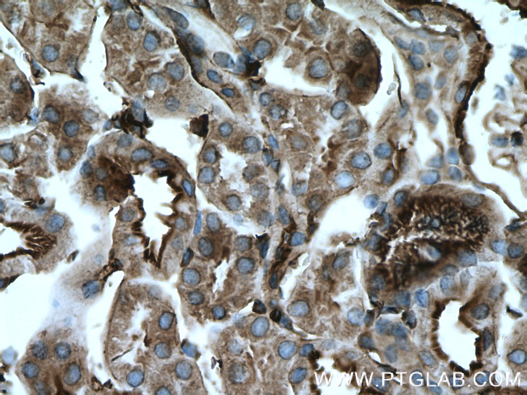 Immunohistochemistry (IHC) staining of mouse kidney tissue using Moesin Polyclonal antibody (16495-1-AP)