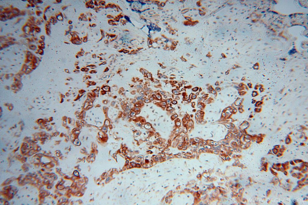 Immunohistochemistry (IHC) staining of human placenta tissue using Moesin Polyclonal antibody (16495-1-AP)