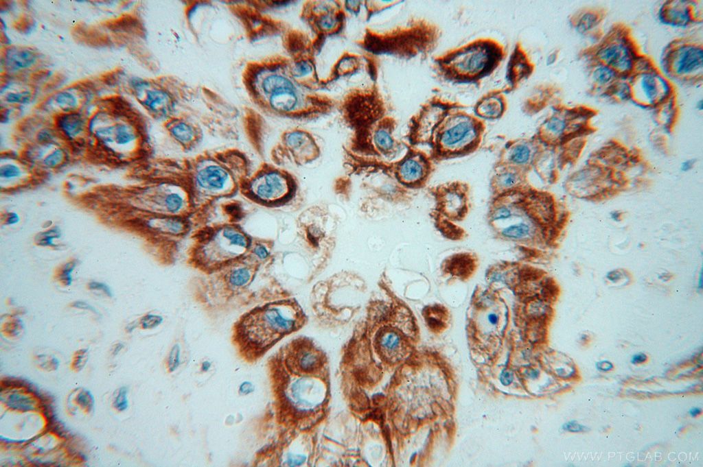 Immunohistochemistry (IHC) staining of human placenta tissue using Moesin Polyclonal antibody (16495-1-AP)