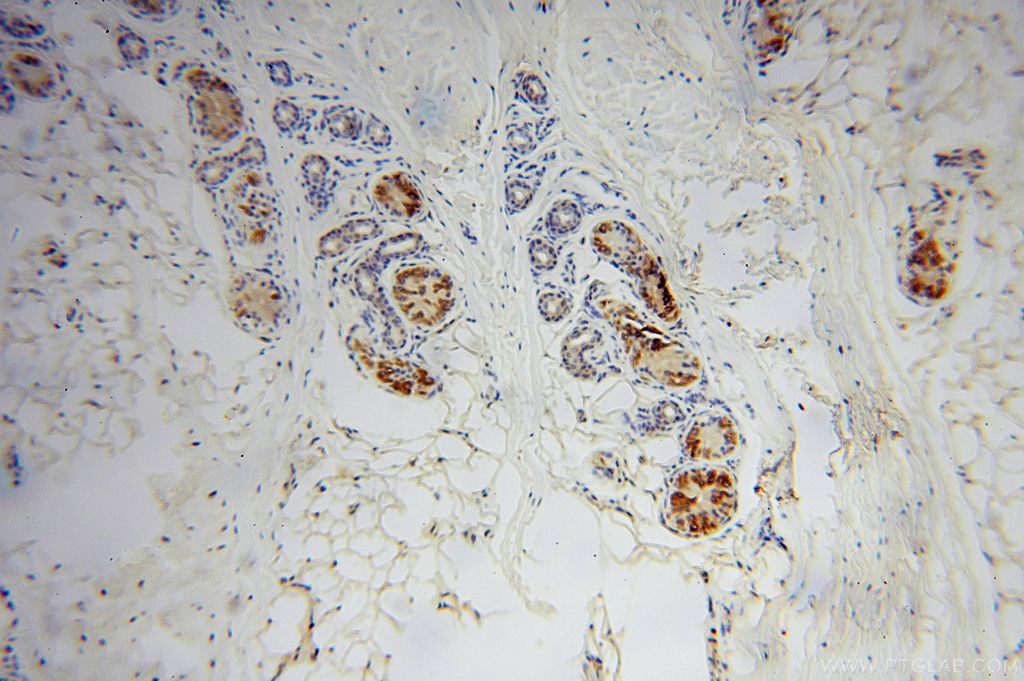 Immunohistochemistry (IHC) staining of human skin tissue using Moesin Polyclonal antibody (16495-1-AP)