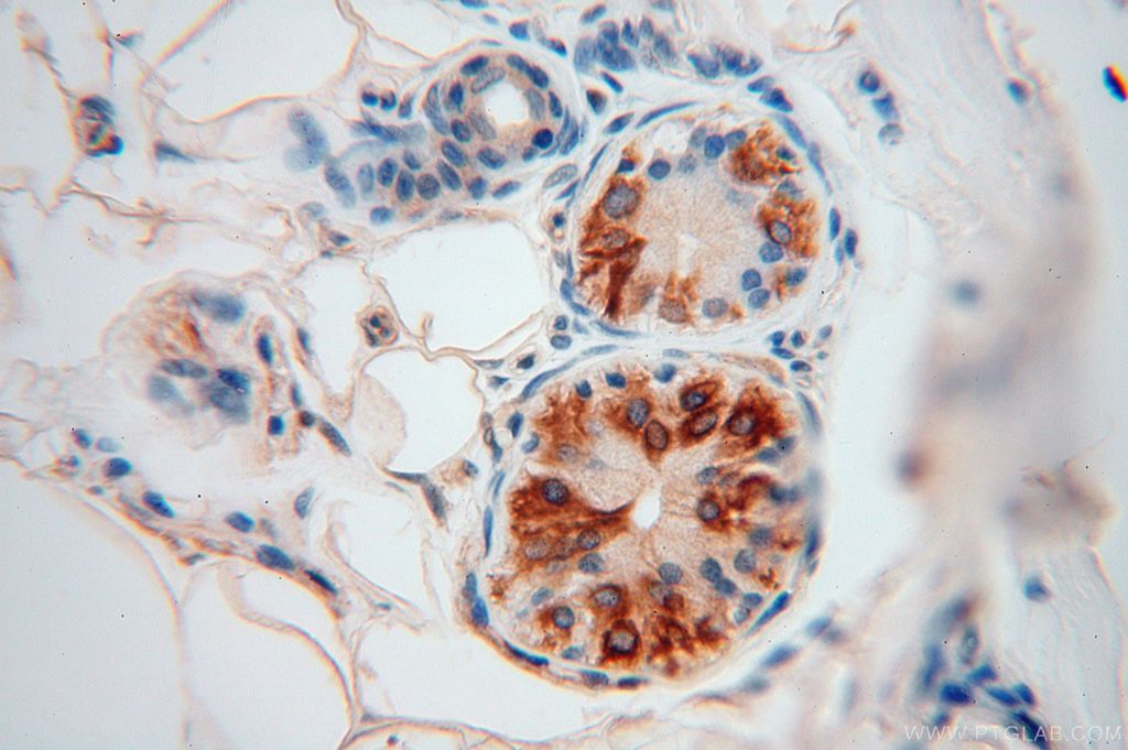 IHC staining of human skin using 16495-1-AP