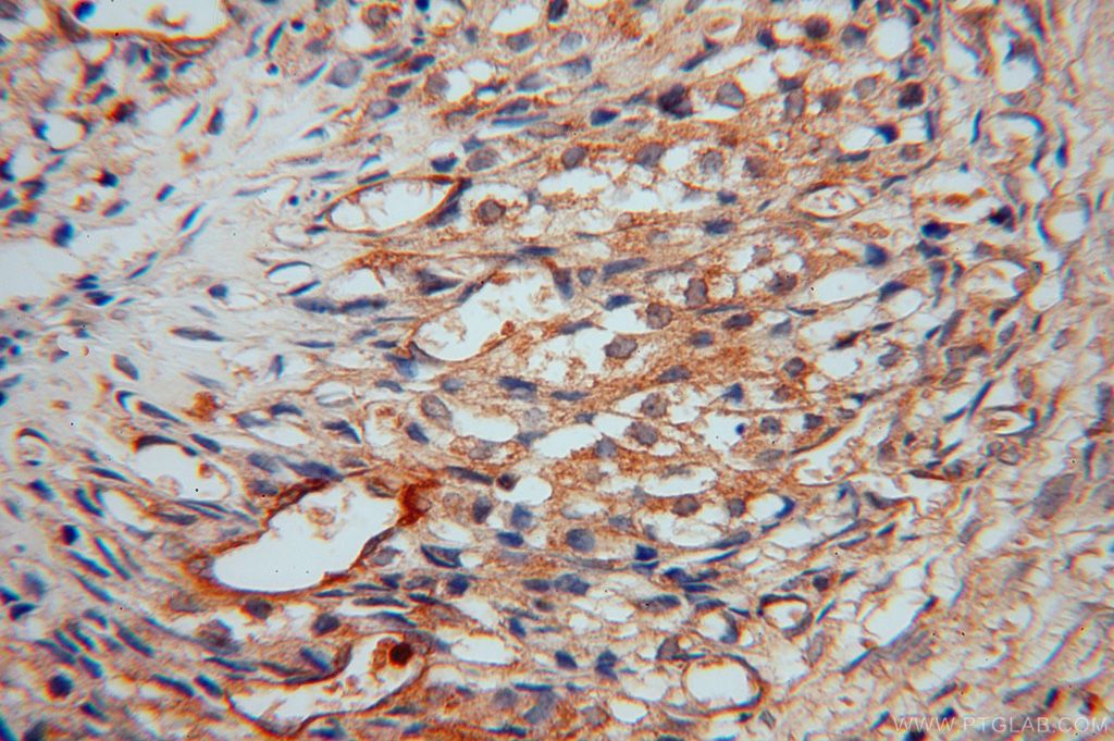 Immunohistochemistry (IHC) staining of human ovary tissue using Moesin Polyclonal antibody (16495-1-AP)