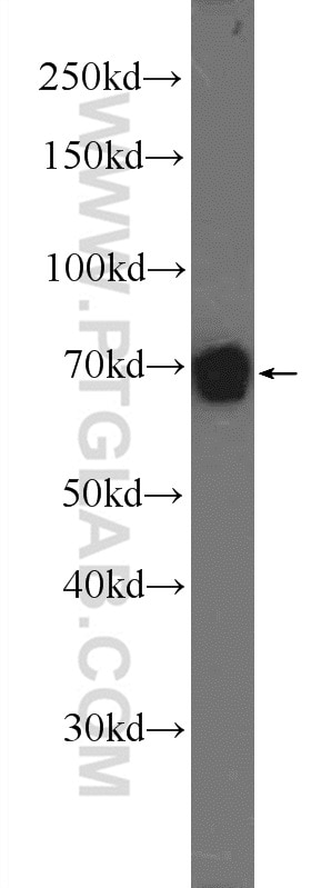 Western Blot (WB) analysis of NIH/3T3 cells using Moesin Polyclonal antibody (16495-1-AP)