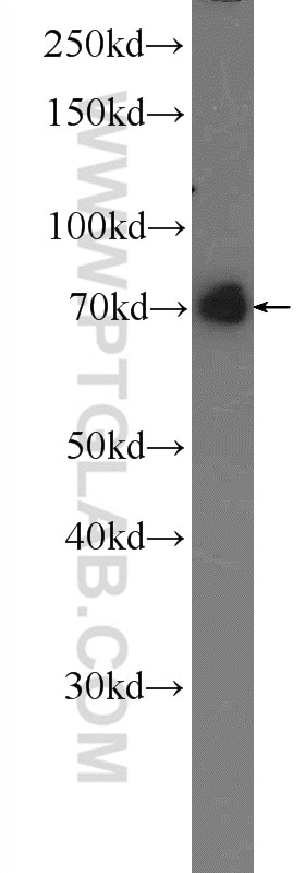 Western Blot (WB) analysis of HeLa cells using Moesin Polyclonal antibody (16495-1-AP)