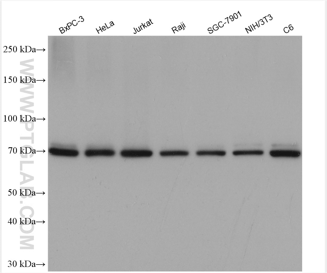 Western Blot (WB) analysis of various lysates using Moesin Polyclonal antibody (16495-1-AP)