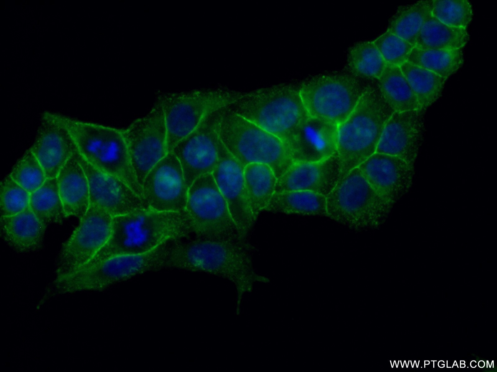 Immunofluorescence (IF) / fluorescent staining of HeLa cells using MSN Polyclonal antibody (26053-1-AP)