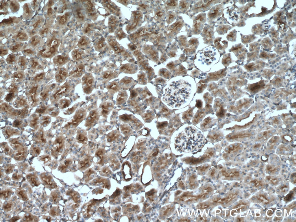 Immunohistochemistry (IHC) staining of mouse kidney tissue using MSN Polyclonal antibody (26053-1-AP)