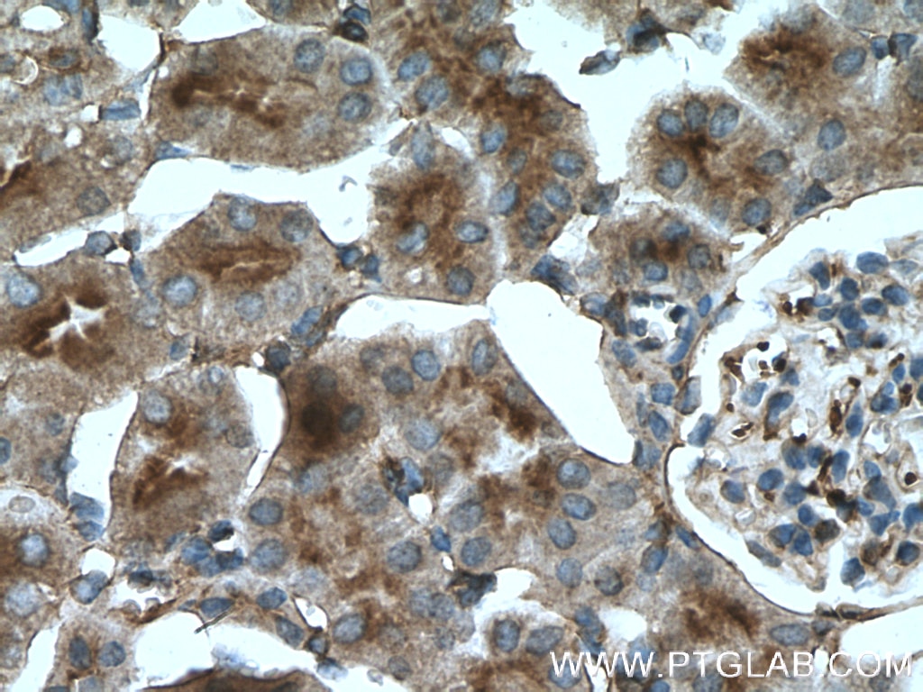 Immunohistochemistry (IHC) staining of mouse kidney tissue using MSN Polyclonal antibody (26053-1-AP)