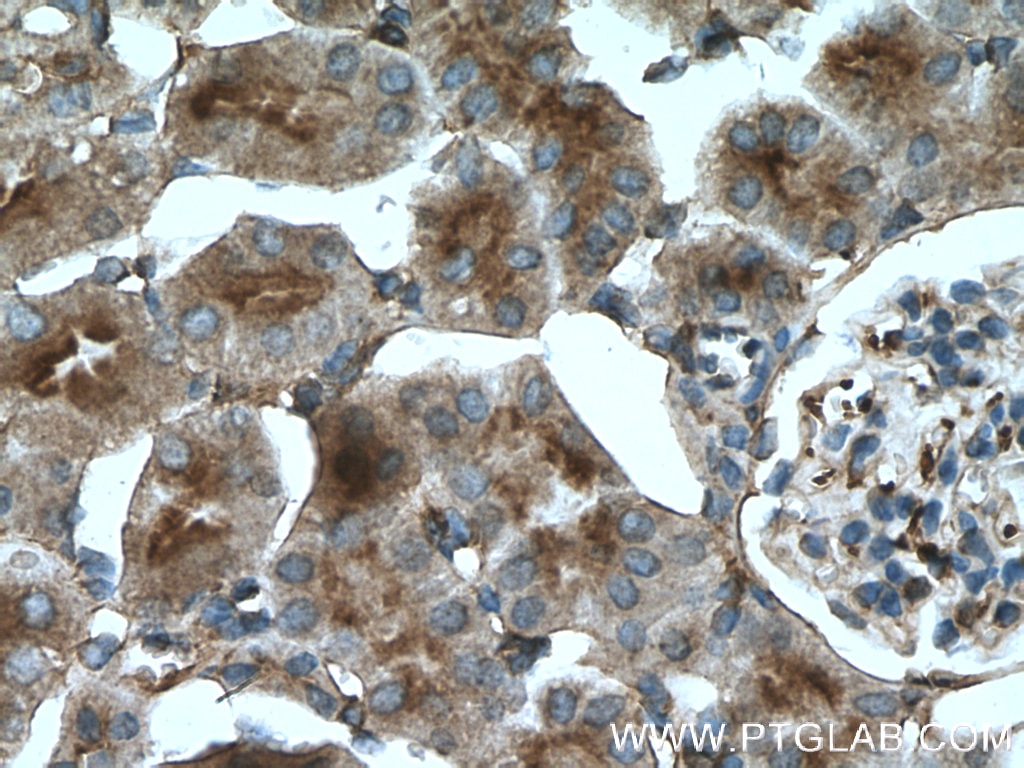 Immunohistochemistry (IHC) staining of mouse kidney tissue using Moesin Polyclonal antibody (26053-1-AP)